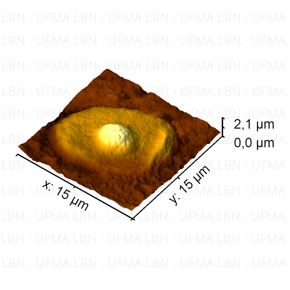 Melanoma 1