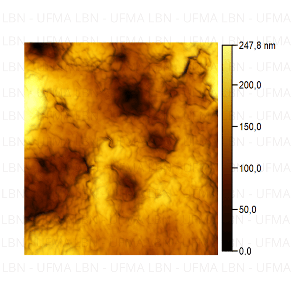 Melanoma 4